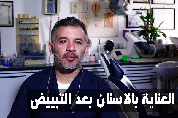 العناية-بالاسنان-بعد-التبييض-2