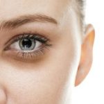 الهالات السوداء