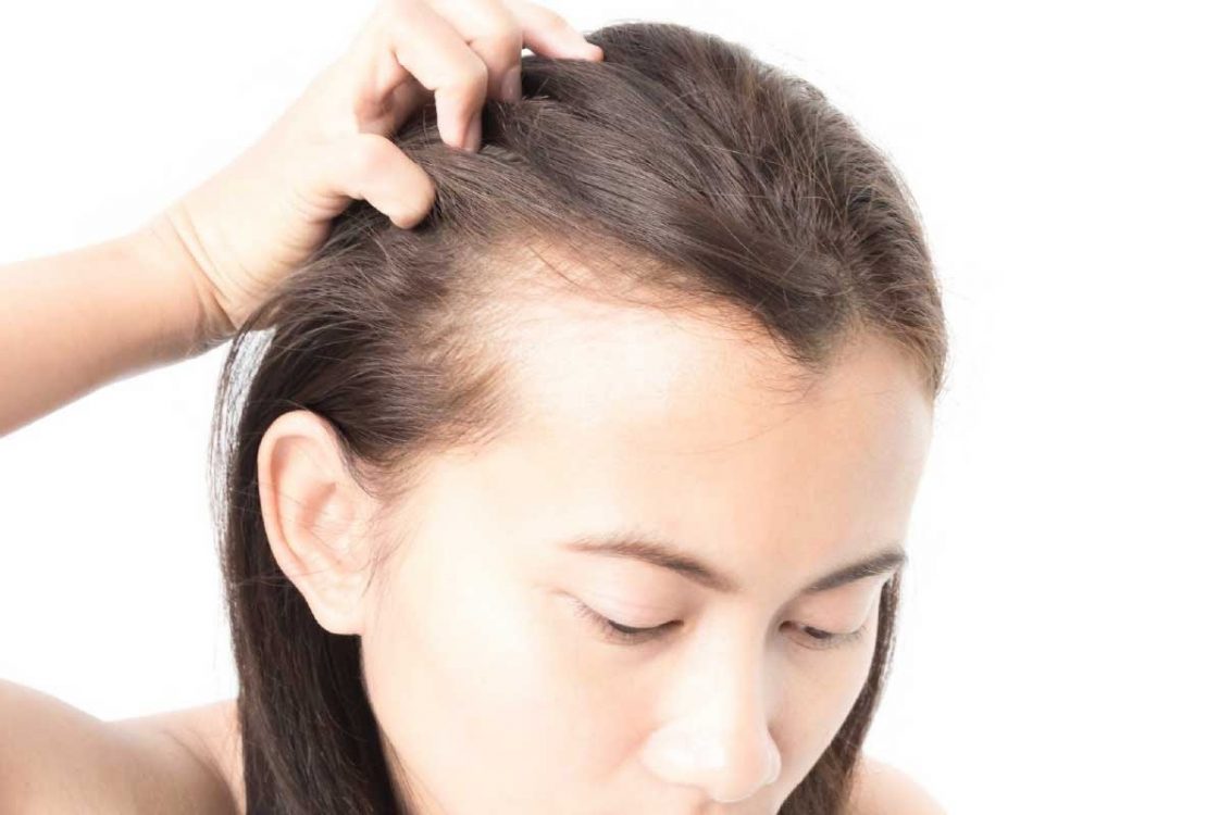6 أسباب لتساقط الشعر المستمر عند النساء، عليكِ التعرف عليها