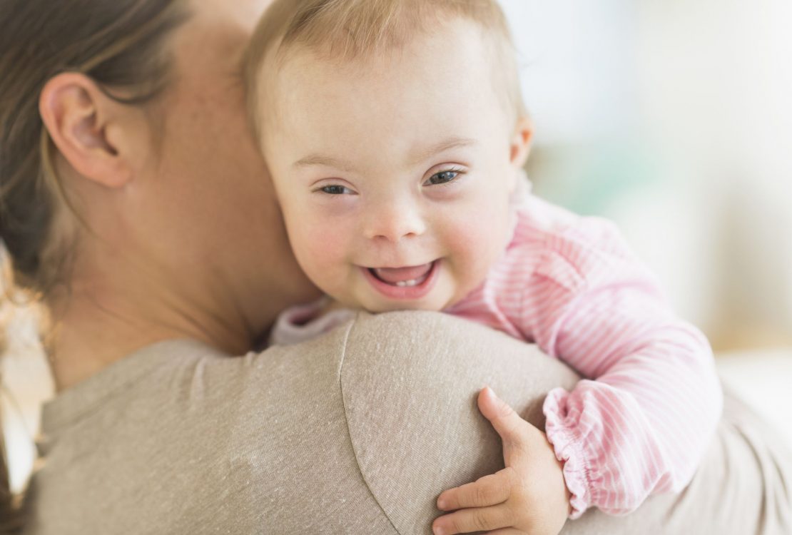 ما هي أعراض متلازمة داون عند الأطفال حديثي الولادة؟