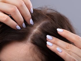 أسباب-الشعر-الهفيف-وكيفية-علاجه