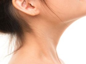 اسباب-وعلاج-اسمرار-الرقبة