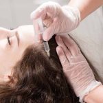 أهمية -حقن -الميزوثيرابي-للشعر