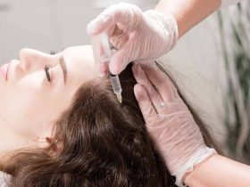 أهمية -حقن -الميزوثيرابي-للشعر