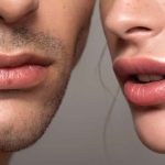 توريد-الشفاه-بالليزر