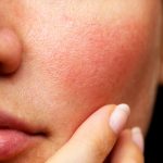 روتين-البشرة-الحساسة